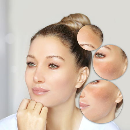 Picture for category Brightening